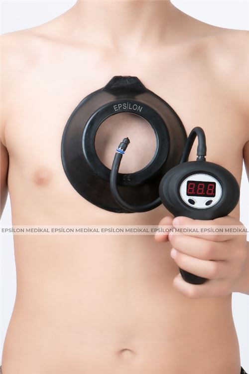 Pectus Vakum fotoğraf 4